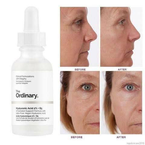 THE ORDINARY Hyaluronic Acid 2% + B5 "ذا أورديناي " image 0