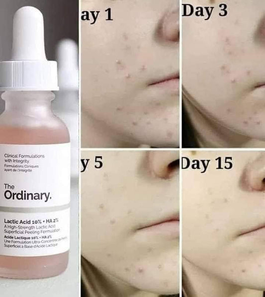 The ordinary lactic acid 5%+ HA"ذا اورديناي " image 0